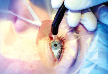 Узнаем подробнее о лазерной коррекции зрения