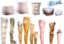 Протезно-ортопедические изделия: виды и назначение